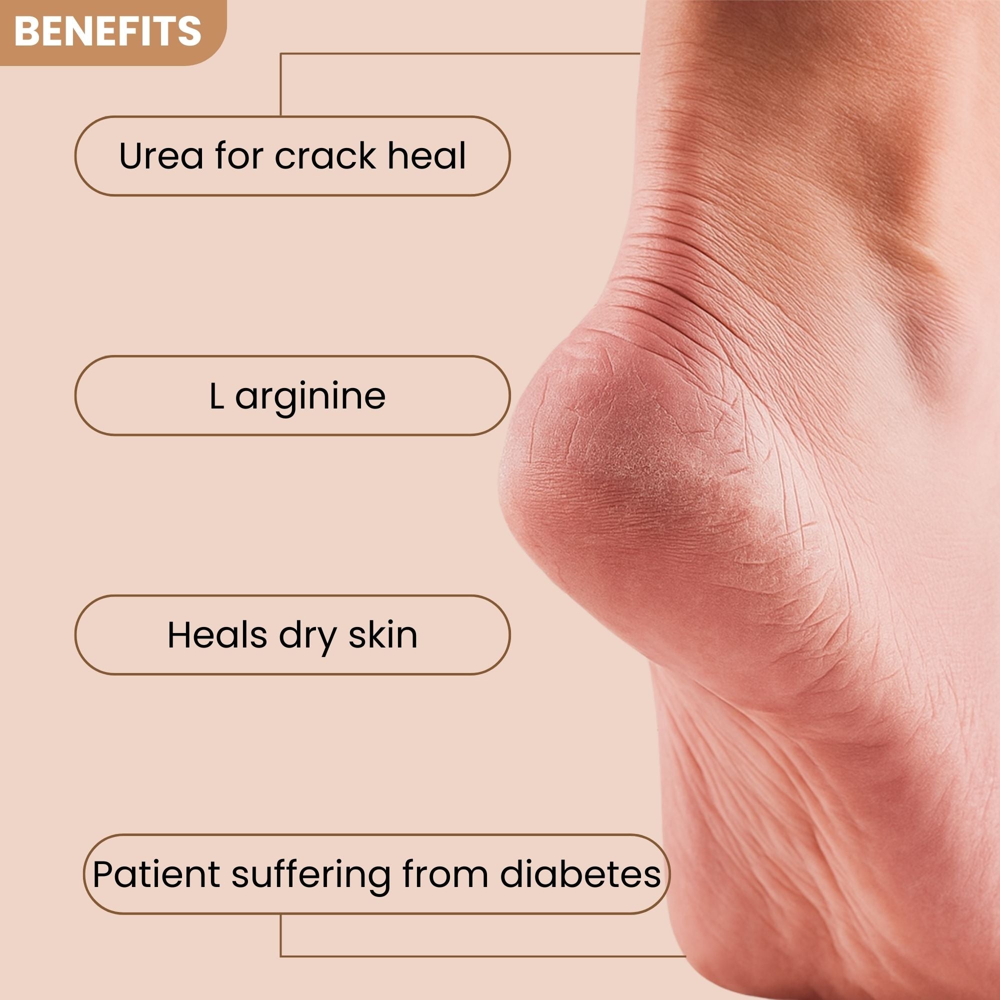 Foot Pro Heel & Hand Repair Cream 75ml – The Secret to Soft, Smooth Feet