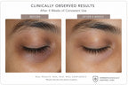Ilift Dark Eye Circles Reset Eye Gel 30ML