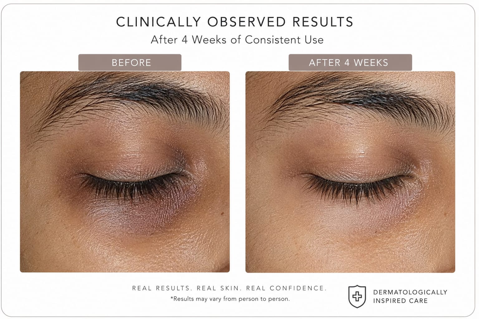 Ilift Dark Eye Circles Reset Eye Gel 30ML