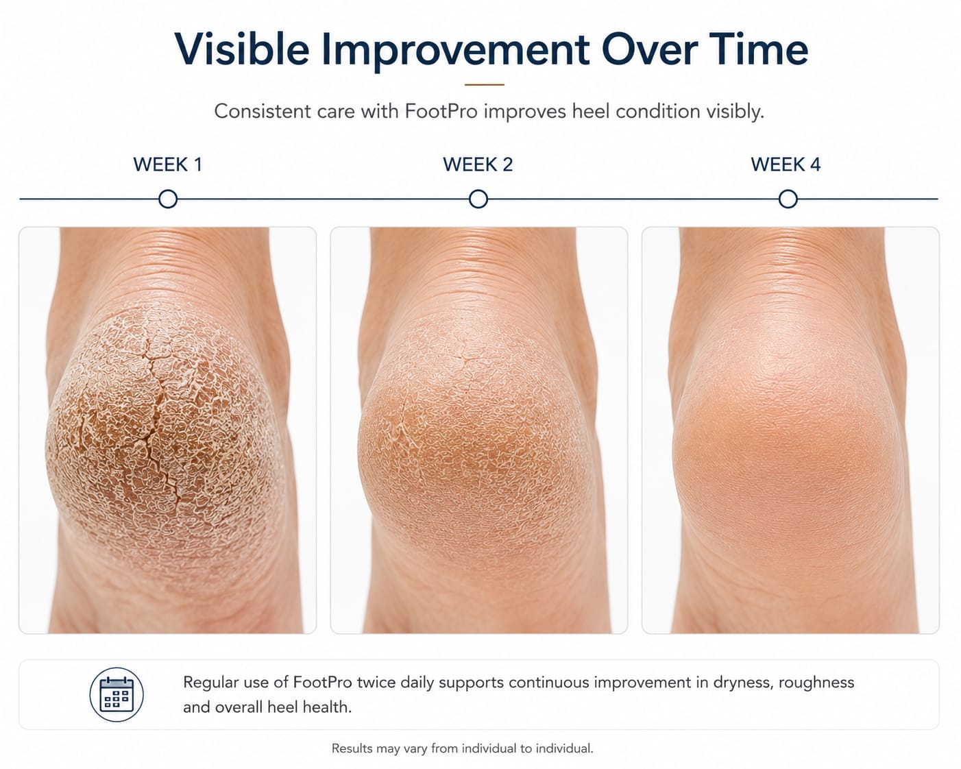 FootPro Heel & Hand Repair Cream 75ml