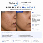 MelLock 20ML