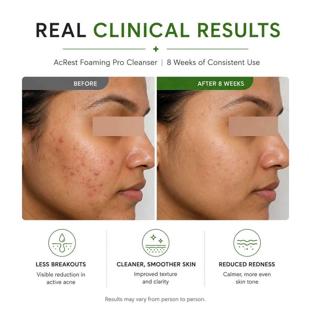 AcRest- Acne Purifying Cleanser 100ml